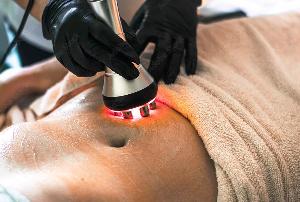 Cavitatie by Body Bloom Studio