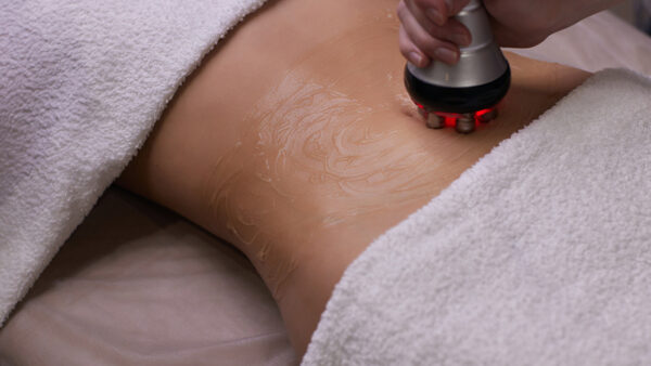 Cavitatie behandeling