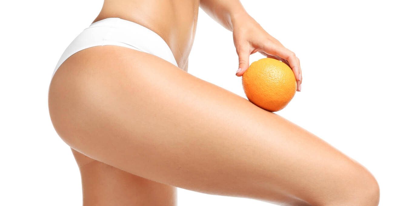 Cellulite behandeling